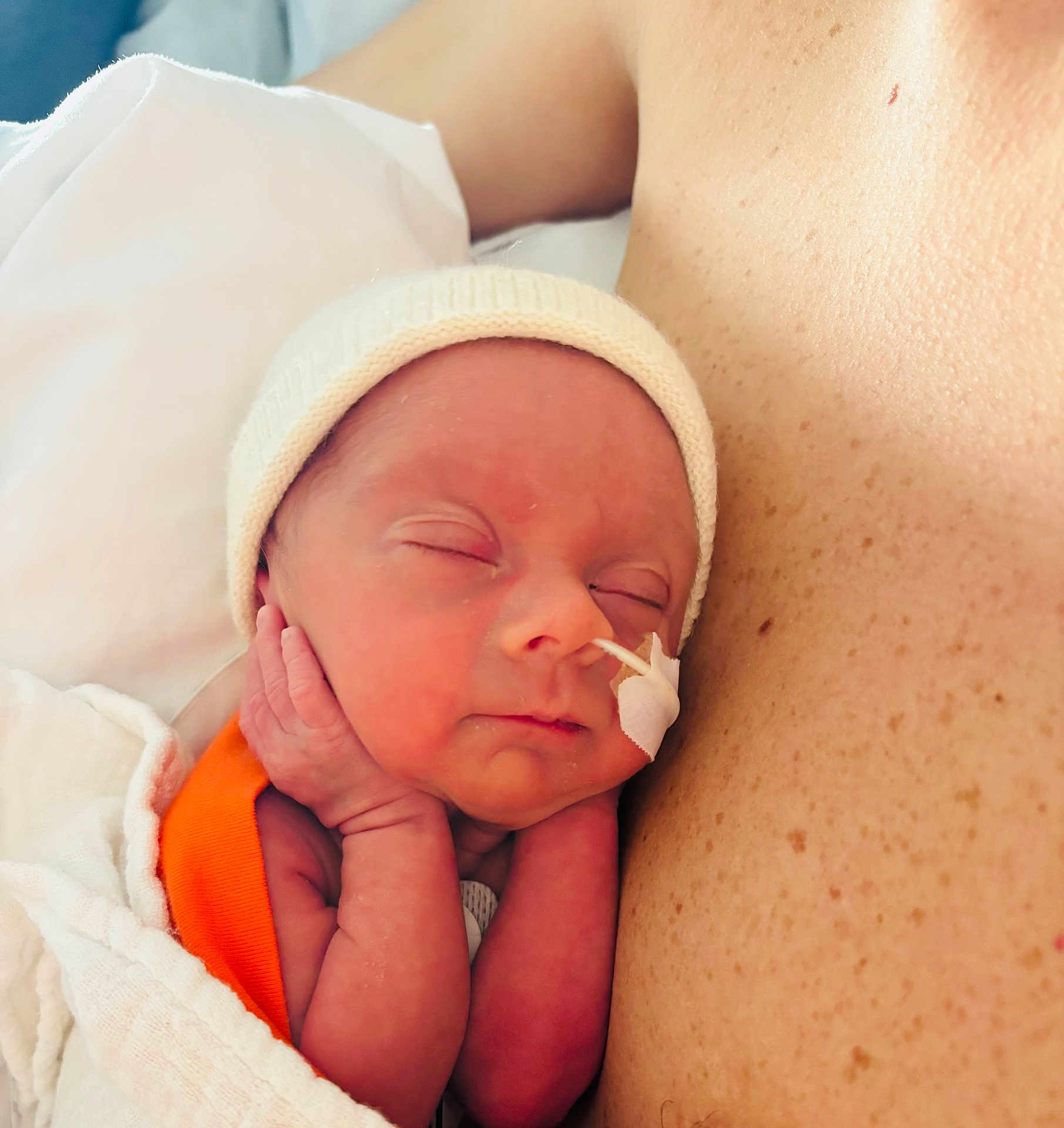 Gabin participe au concours pour gagner de l'argent avec cette photo : newborn, infant, baby, sleeping, nasogastric_tube, medical_tape, beanie, blanket, swaddled, tiny_hands, closeup, portrait, hospital, parent, chest, freckled_skin, peaceful, skin, healthcare, soft_lighting