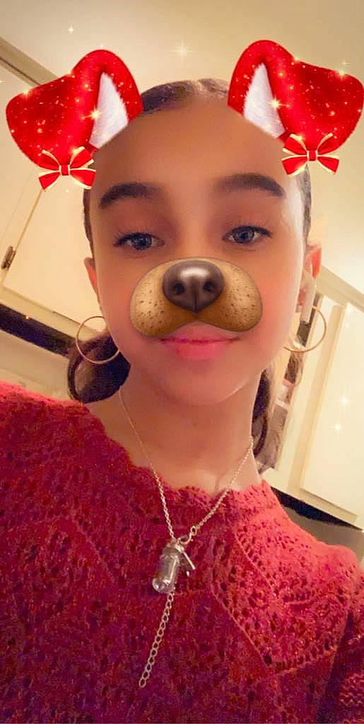 Aliana joined the competition — help win amazing prizes! cheek, chin, ear, eyebrow, face, fawn, forehead, hair, head, lip, nose, person, pink, red, selfie, skin, smile