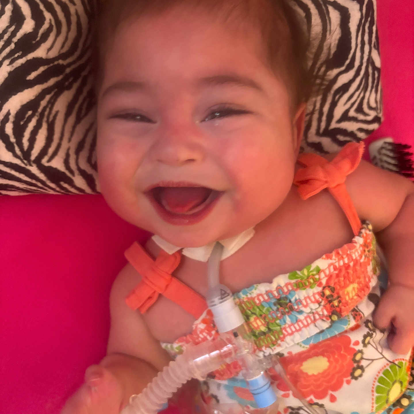 Kathryn Joy joined the competition — help win amazing prizes! baby, bed, cheeks, closeup, cute, eye_makeup, fabric, face, floral_dress, hand, happy, infant, laughing, medical_tube, orange_bow, pink_background, portrait, smiling, tracheostomy_tube, zebra_print_pillow