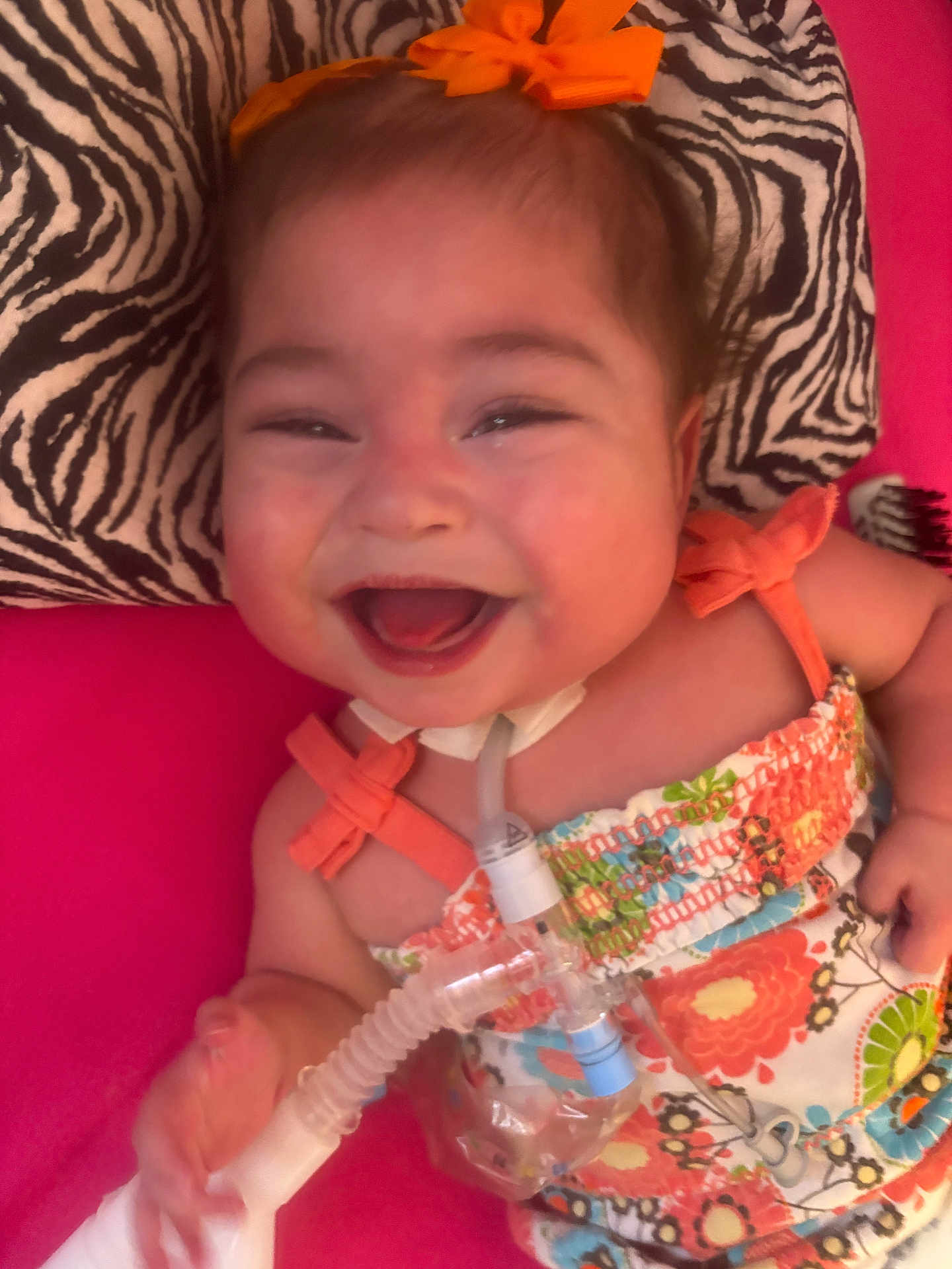 Kathryn Joy joined the competition — help win amazing prizes! baby, infant, smiling, laughing, face, orange_bow, zebra_print_pillow, floral_dress, pink_background, hand, closeup, portrait, medical_tube, tracheostomy_tube, happy, cute, fabric, bed, eye_makeup, cheeks