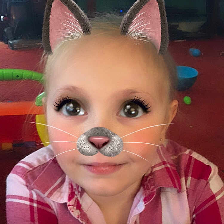 Gracelynn joined the competition — help win amazing prizes! cat, ear, eye, fawn, head, nose, person, snout, whiskers