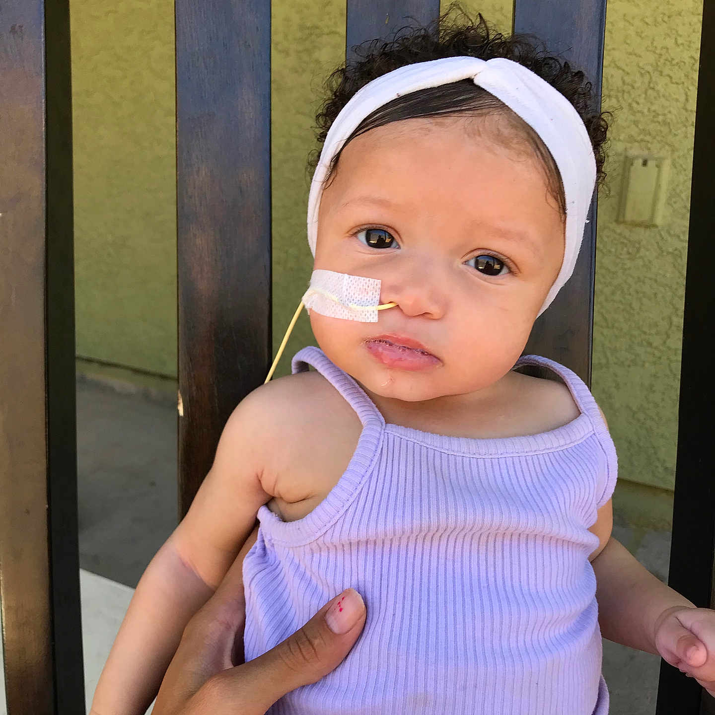 Zenecia is registered to the contest to win money with this photo: baby, child, curly_hair, expression, eyes, face, feeding_tube, fence, hand, headband, infant, medical, nasal_tube, outdoor, person, purple_outfit, sitting, skin, sleeveless, wood