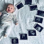 baby, infant, smiling, lying_down, striped_clothing, white_blanket, ultrasound_images, medical_images, happy, cute, child, portrait, newborn, baby_clothes, soft_texture, indoor, person, celebration, family, announcement