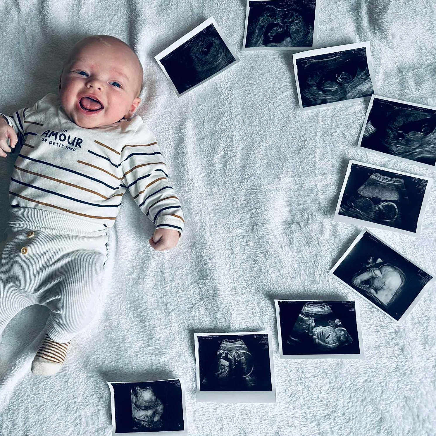 Maïlo a rejoint le concours — aidez-le/la à gagner de superbes lots ! announcement, baby, baby_clothes, celebration, child, cute, family, happy, indoor, infant, lying_down, medical_images, newborn, person, portrait, smiling, soft_texture, striped_clothing, ultrasound_images, white_blanket