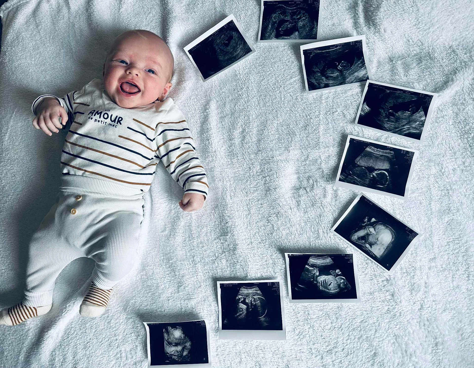 Maïlo a rejoint le concours — aidez-le/la à gagner de superbes lots ! baby, infant, smiling, lying_down, striped_clothing, white_blanket, ultrasound_images, medical_images, happy, cute, child, portrait, newborn, baby_clothes, soft_texture, indoor, person, celebration, family, announcement