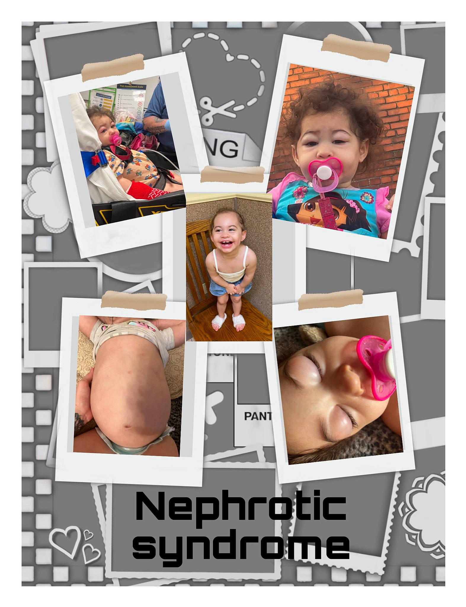 Alaïa is registered to the contest to win money with this photo: abdomen, advertising, art, baby, chest, child, collage, eyelash, facial_expression, font, happy, joy, magenta, pattern, person, photomontage, picture_frame, product, rectangle, room