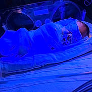 Jonas joined the competition — help win amazing prizes! baby, incubator, hospital, phototherapy, blue_light, mesh_blanket, pacifier, eye_mask, newborn, medical_equipment, infant, sleeping, healthcare, nursery, patient, swaddled, clinic, care, bed, rest