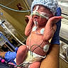 Santiago is registered to the contest to win money with this photo: newborn, baby, hospital, medical_equipment, gloved_hand, blue_hat, diaper, wired, monitoring_pads, intensive_care, tiny, fragile, person, infant, healthcare, neonatal, cute, patient, care, hand