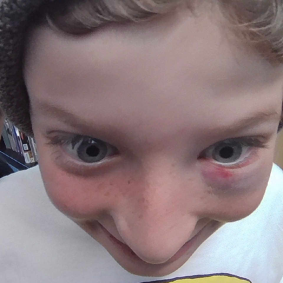 Tortellinigarlico joined the competition — help win amazing prizes! accessories, baby, bodypart, cap, clothing, earring, face, freckle, glasses, happy, hat, head, jewelry, person, photography, piercing, portrait, selfie, skin, smile