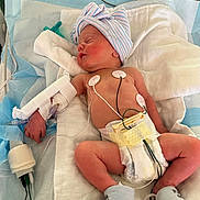 Haizlee is registered to the contest to win money with this photo: newborn, baby, infant, hospital, bassinet, diaper, striped_hat, blanket, sleeping, electrodes, monitoring_wires, iv, arm_bandage, medical_equipment, patient, tiny_feet, skin, napping, cute, healthcare