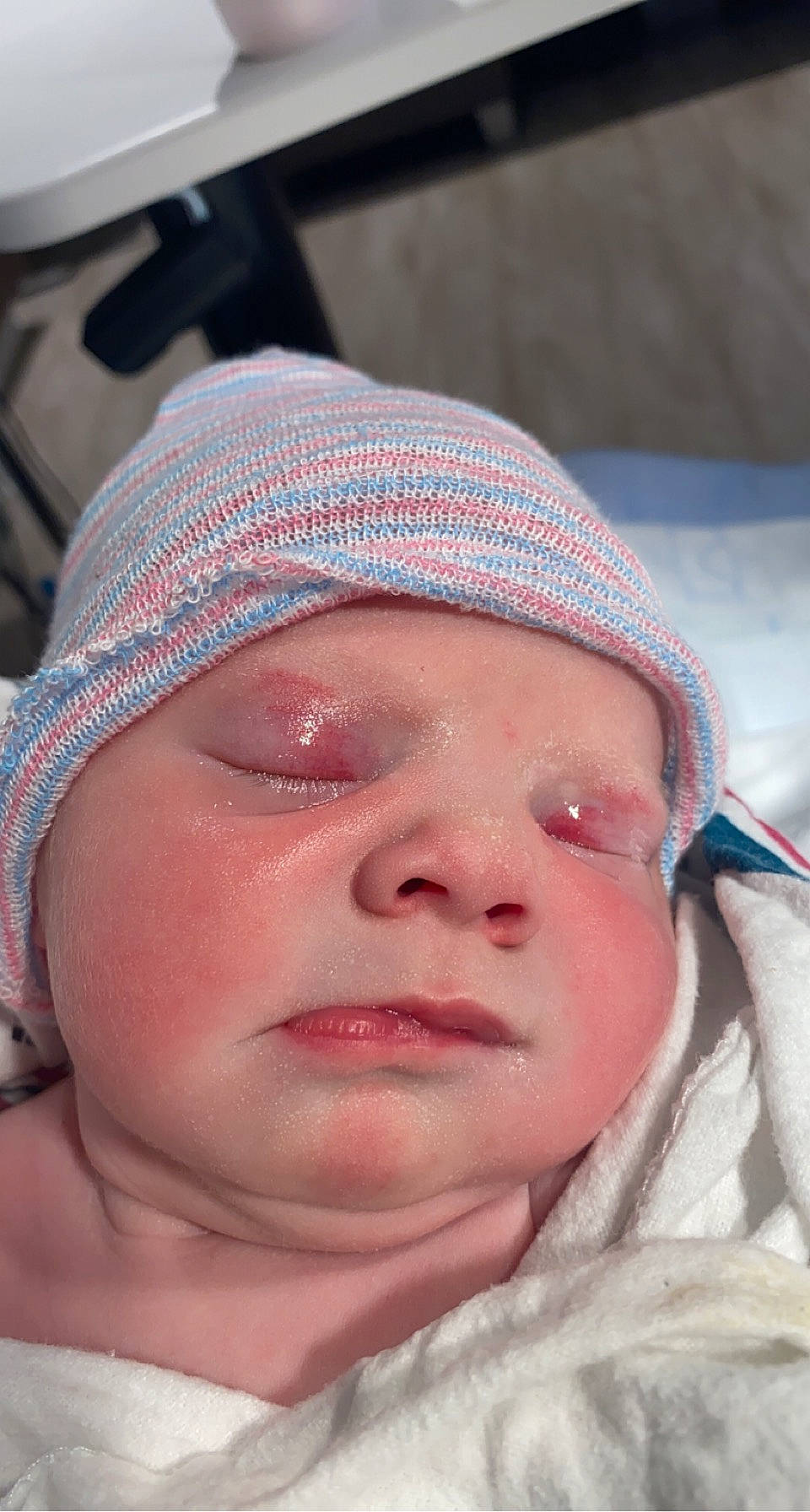 Zayleigh is registered to the contest to win money with this photo: cap, cheek, chin, eye, eyelash, eyewear, face, facial_expression, forehead, hair, headgear, headwear, human, jaw, lip, mouth, nose, person, pink, skin