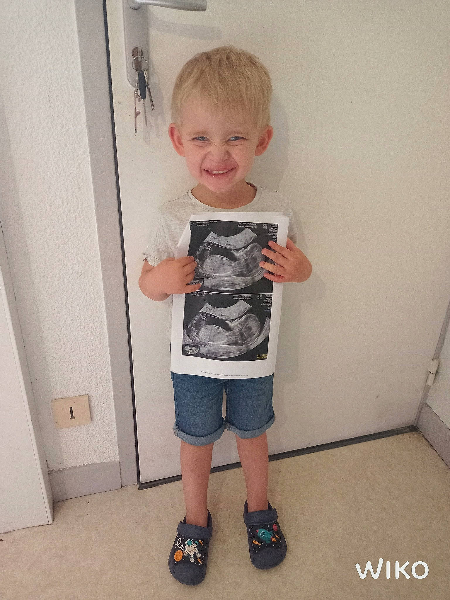 Alessio participe au concours pour gagner de l'argent avec cette photo : active_shorts, baby_toddler_clothing, bermuda_shorts, calf, elbow, face, head, human_body, human_leg, joy, knee, leg, pattern, person, shorts, sleeve, smile, t_shirt, thigh, toddler