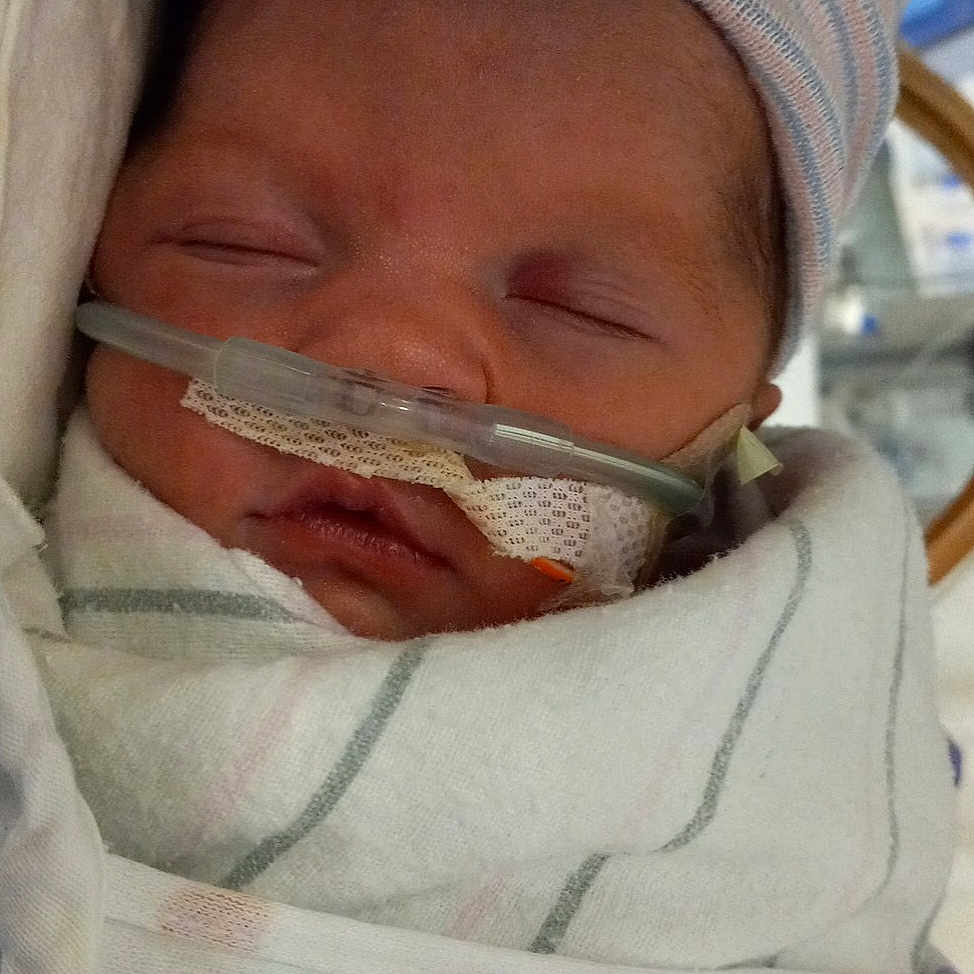 Selaya is registered to the contest to win money with this photo: baby, cheek, child, chin, comfort, eye, eyebrow, eyelash, face, finger, hand, headgear, human_body, jaw, medical, mouth, neck, nose, skin, toddler