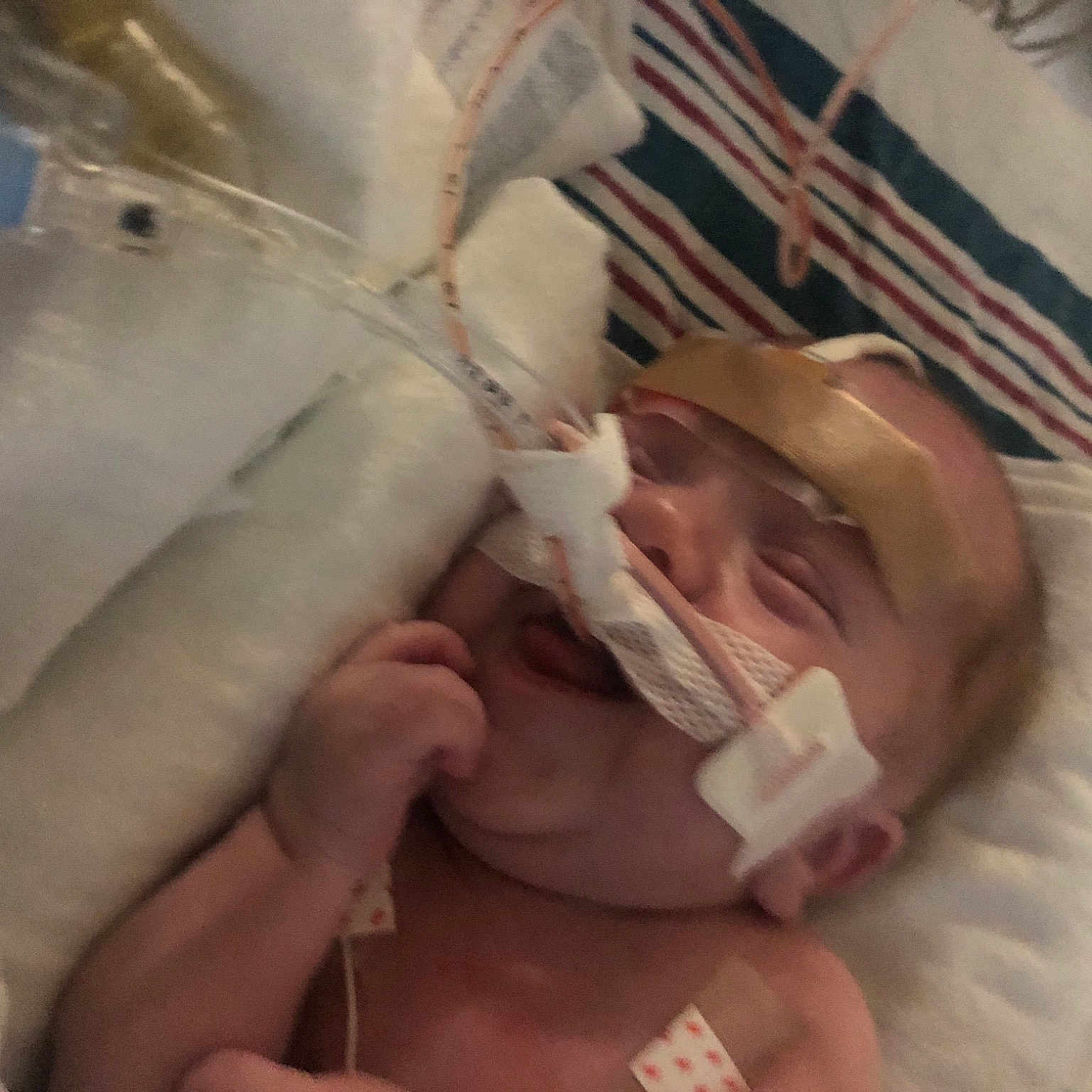 Roy is registered to the contest to win money with this photo: baby, child, childbirth, comfort, event, flesh, health_care, hospital, linens, medical, medical_equipment, medical_procedure, nail, patient, peach, room, service, thumb, toddler