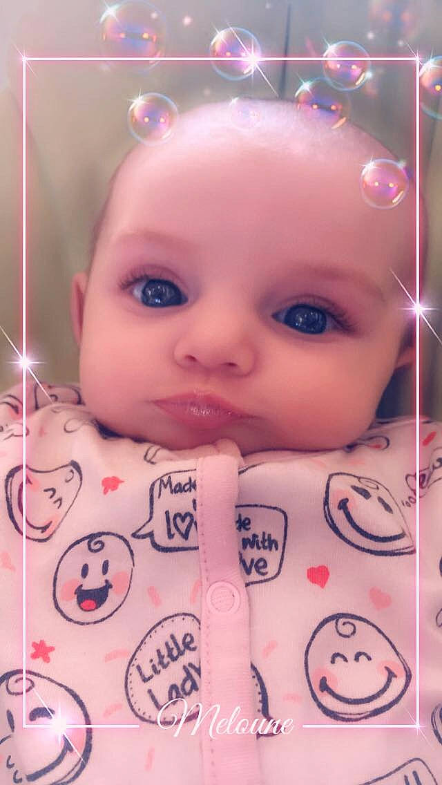 Lucile a rejoint le concours — aidez-le/la à gagner de superbes lots ! baby, cheek, child, eye, eyebrow, eyelash, face, forehead, head, lip, mouth, nose, person, pink, product, skin, smile, toddler