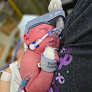 Teagan joined the competition — help win amazing prizes! baby, caregiver, close_up, clothing, hand, headband, healthcare, hospital, hospital_gown, infant, medical_equipment, nasal_cannula, newborn, patient, person, resting, skin, sleeping, tender_moment, tube
