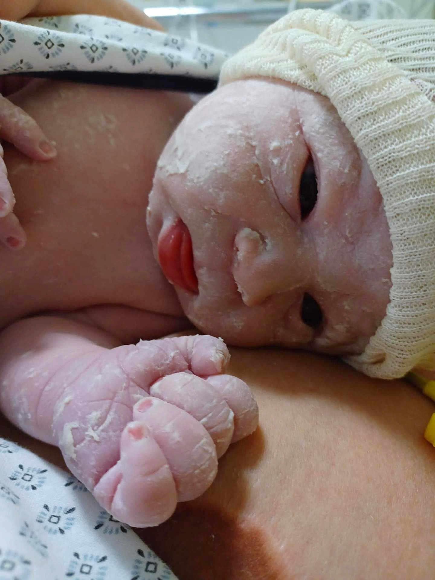 Sidney a rejoint le concours — aidez-le/la à gagner de superbes lots ! newborn, baby, infant, skin_peeling, hand, face, knitted_cap, sleepy, close_up, resting, person, cute, tiny_fingers, skin, human, baby_clothing, soft_light, indoors, portrait, newborn_skin