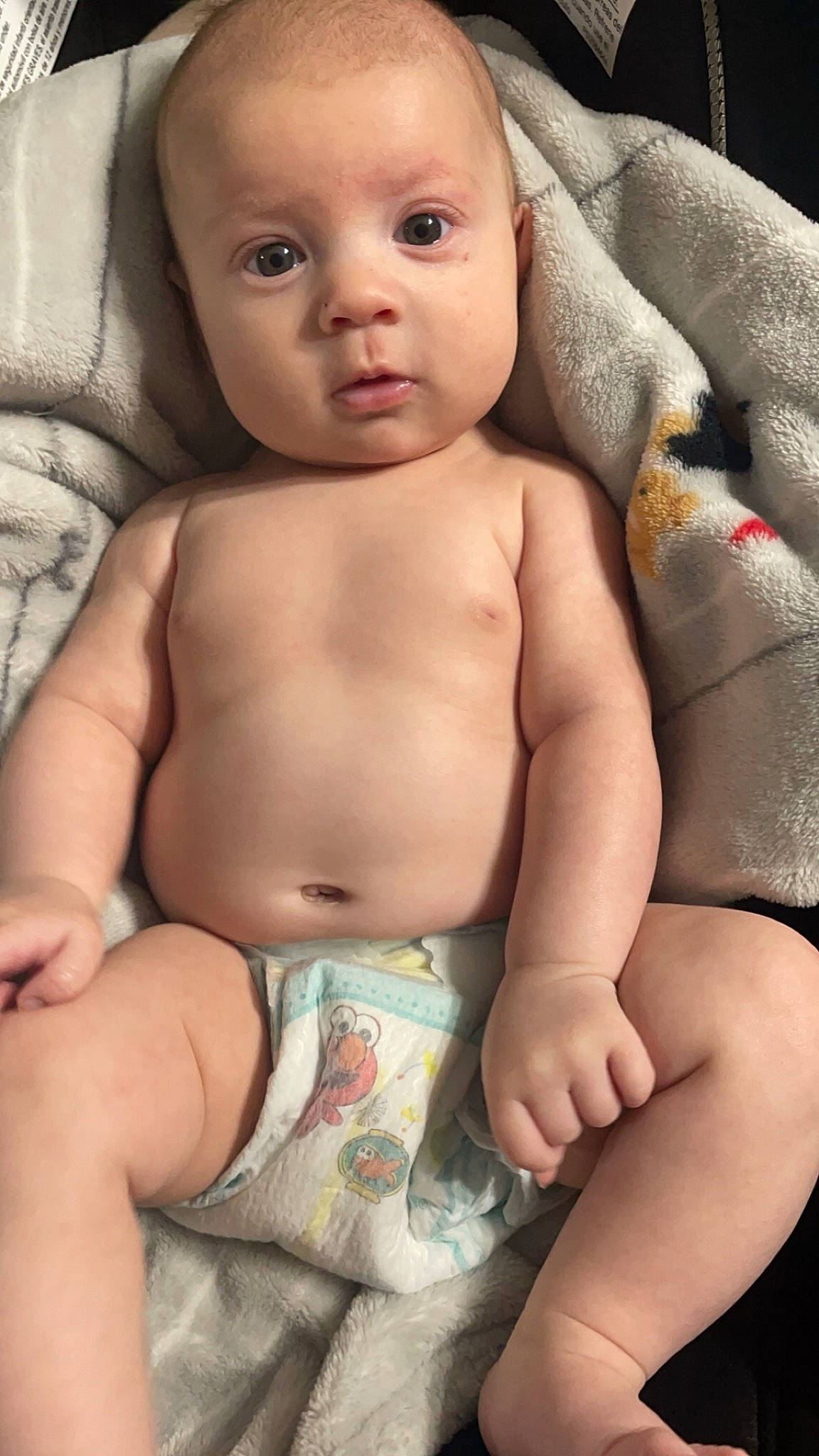Riley joined the competition — help win amazing prizes! arm, baby, cheek, chin, comfort, eye, eyebrow, face, finger, iris, joint, lip, mouth, muscle, neck, nose, organ, person, skin, stomach