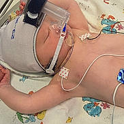 Luke joined the competition — help win amazing prizes! baby, medical_equipment, hospital, blanket, duck_pattern, hand, infant, monitoring_wires, nasal_cannula, cap, bed, caregiver, skin, resting, patient, healthcare, child, person, lying_down, treatment