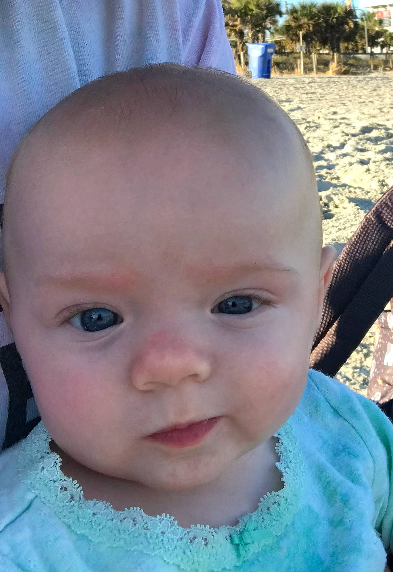 Iris is registered to the contest to win money with this photo: baby, baby_toddler_clothing, cheek, child, chin, ear, eyebrow, eyelash, fun, grass, happy, iris, lip, mouth, nose, person, sitting, skin, toddler, tree