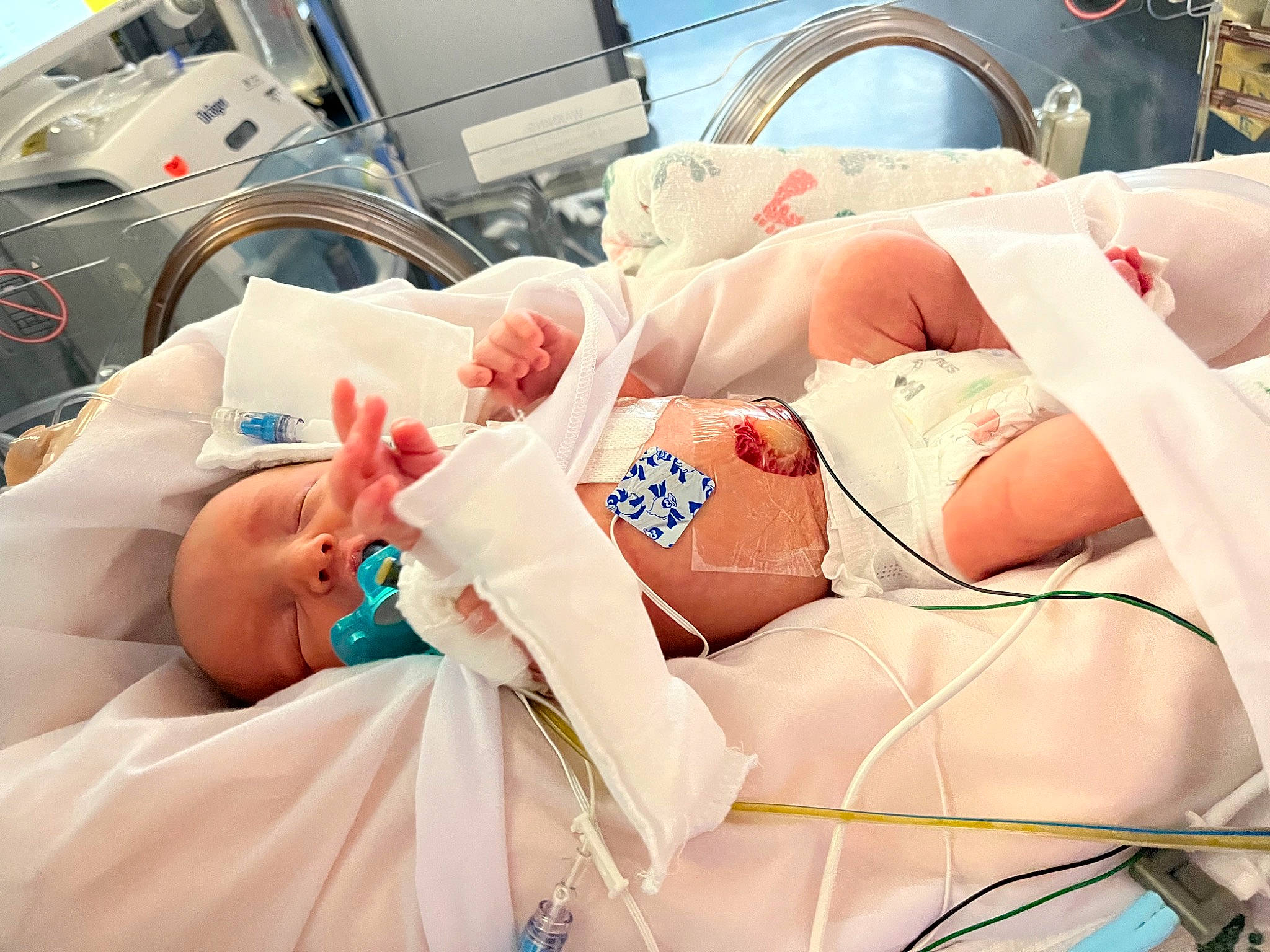 Aj joined the competition — help win amazing prizes! abdomen, bed, chest, childbirth, comfort, event, health_care, hospital, hospital_bed, human_body, human_leg, linens, medical, medical_equipment, medical_procedure, patient, person, room, service, skin