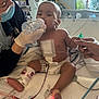 baby, hospital, medical_equipment, caregiver, mask, gloves, feeding_bottle, diaper, bandage, monitoring_wires, hand_holding, bed, medical_tape, infant, patient, healthcare, treatment, child, medical_care, person