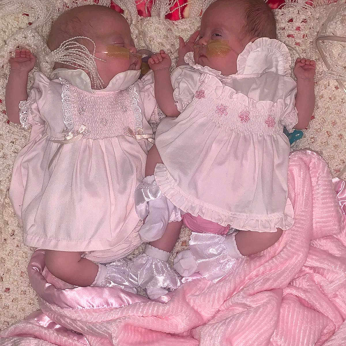 Bonnie Miamie Doyle is registered to the contest to win money with this photo: baby, blanket, child, crocheted_blanket, cute, healthcare, indoors, infant, lying_down, medical_care, nasal_tube, newborn, person, pink_blanket, pink_dress, resting, sleeping, socks, soft_texture, twin_babies