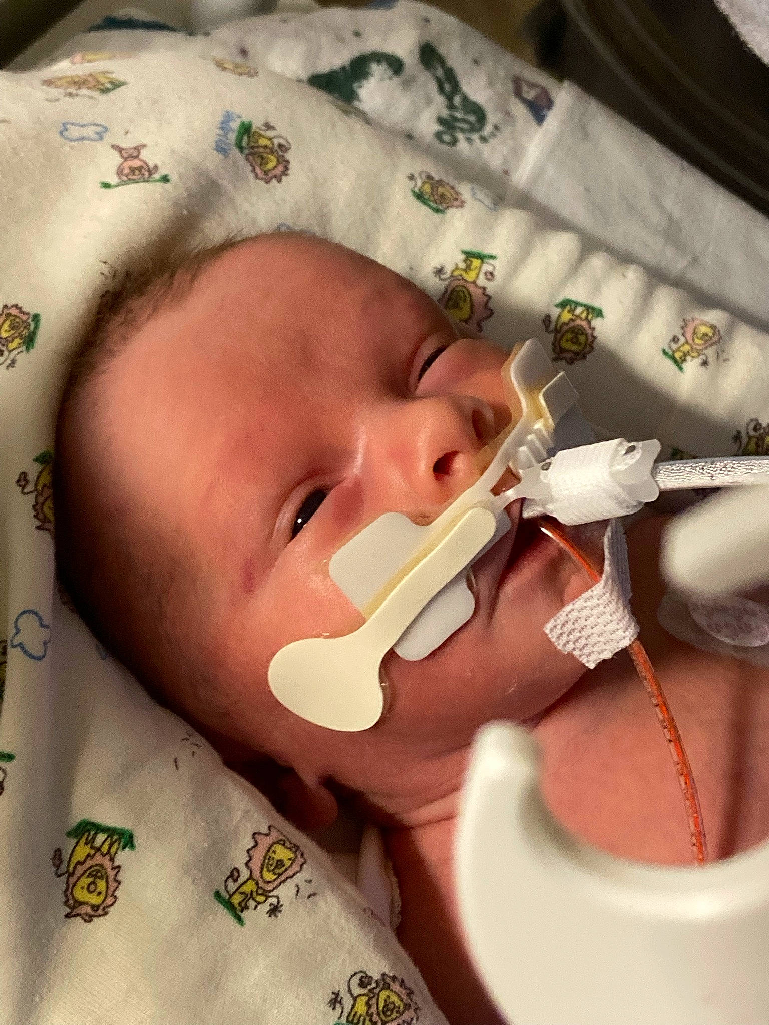 Joshua joined the competition — help win amazing prizes! baby, baby_toddler_clothing, cheek, child, chin, close_up, comfort, cosmetic_dentistry, dentures, ear, eyebrow, eyelash, jaw, lip, medical, mouth, nose, person, skin, thumb