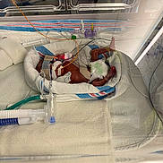 Demetria is registered to the contest to win money with this photo: baby, premature, incubator, hospital, medical_equipment, blanket, tubes, monitoring, newborn, infant, healthcare, bed, clinic, person, fragile, diaper, sensor, care, neonatal, tiny