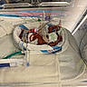 baby, premature, incubator, hospital, medical_equipment, blanket, tubes, monitoring, newborn, infant, healthcare, bed, clinic, person, fragile, diaper, sensor, care, neonatal, tiny