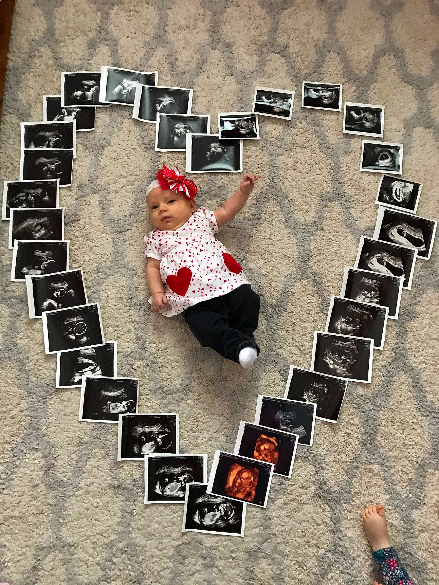 Emelia joined the competition — help win amazing prizes! art, font, games, headwear, heart, illustration, love, person, photography, photomontage, play, red, wall