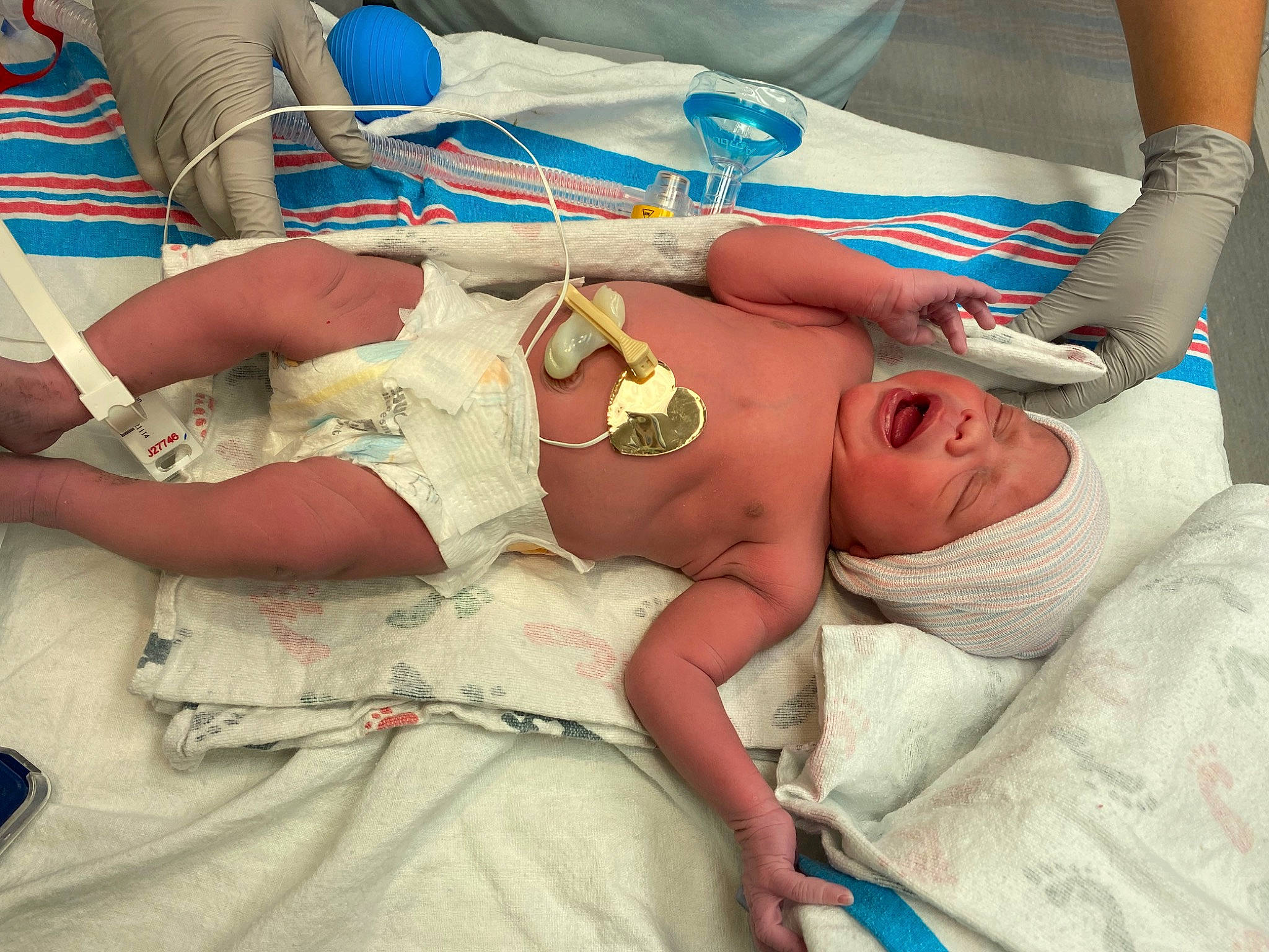 Abigail joined the competition — help win amazing prizes! abdomen, arm, baby, chest, comfort, elbow, hand, headwear, health_care, hospital, human_body, joint, leg, medical, medical_equipment, medical_procedure, patient, person, service, stomach