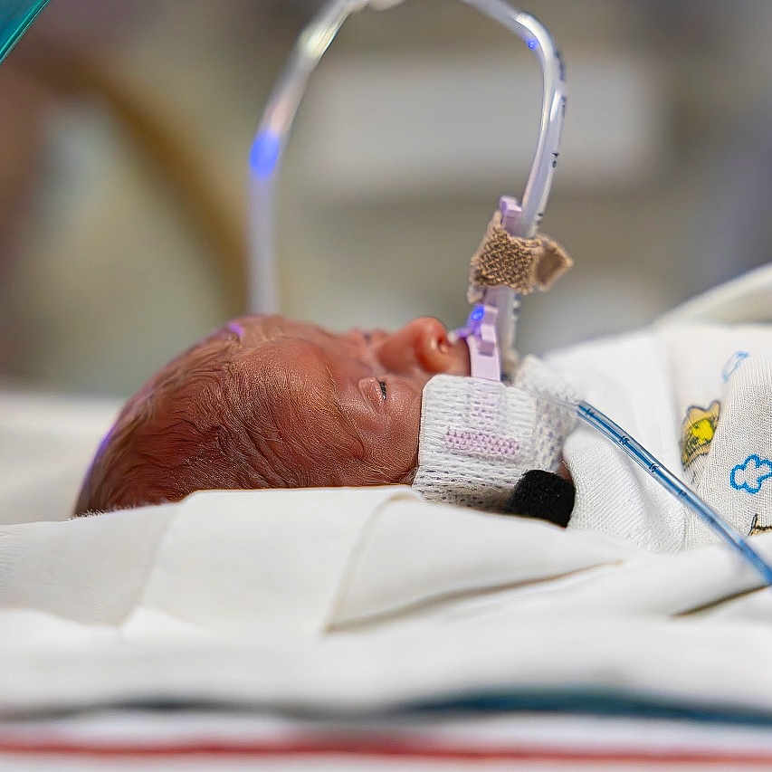 Zenalla joined the competition — help win amazing prizes! baby, bed, blanket, child, closeup, cute, face, fragile, healthcare, hospital, infant, medical_tubes, neonatal, newborn, person, premature_baby, resting, sleeping, soft, white