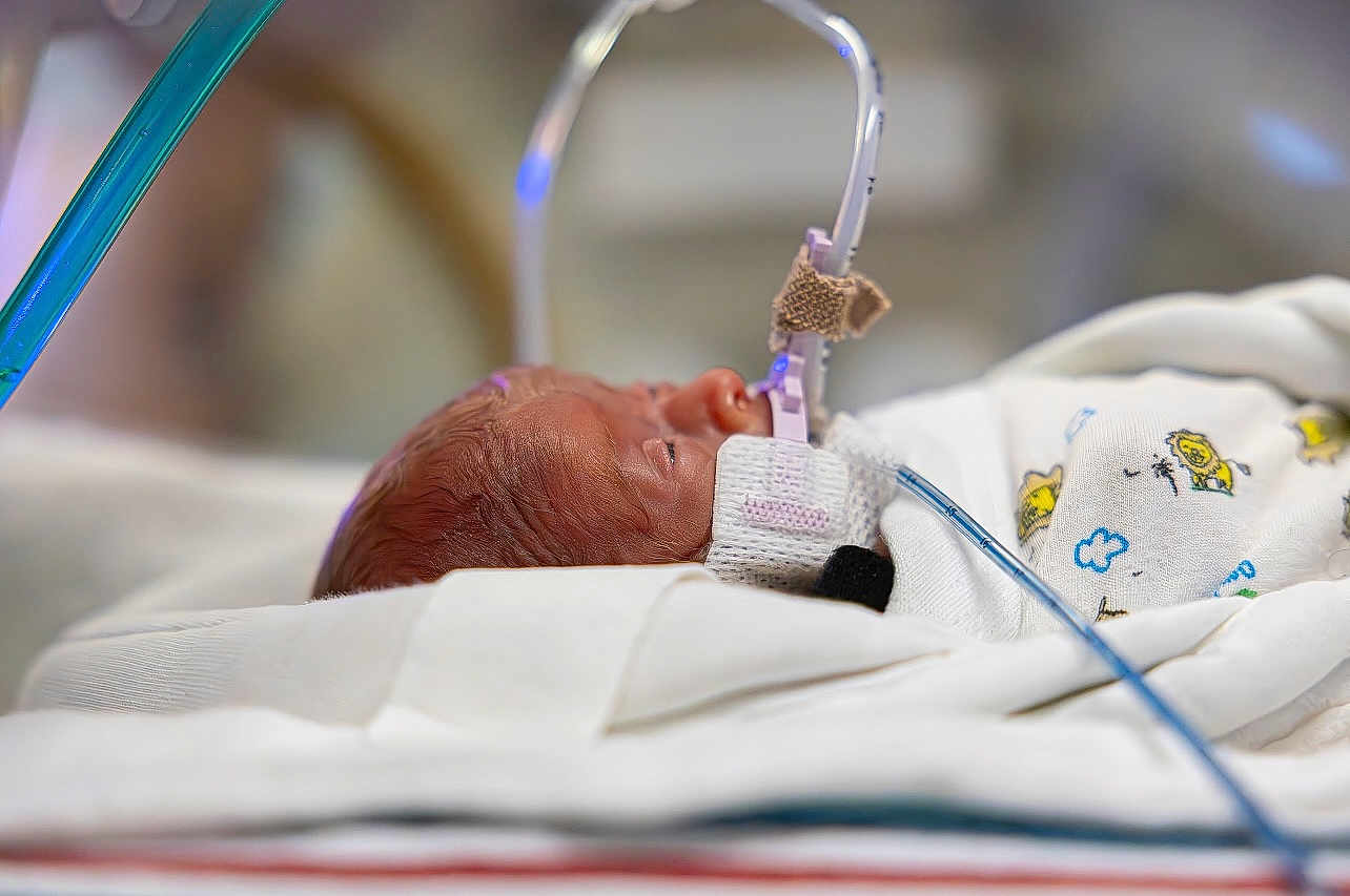 Zenalla joined the competition — help win amazing prizes! newborn, baby, hospital, medical_tubes, blanket, infant, premature_baby, face, sleeping, healthcare, neonatal, cute, child, person, bed, closeup, fragile, resting, white, soft