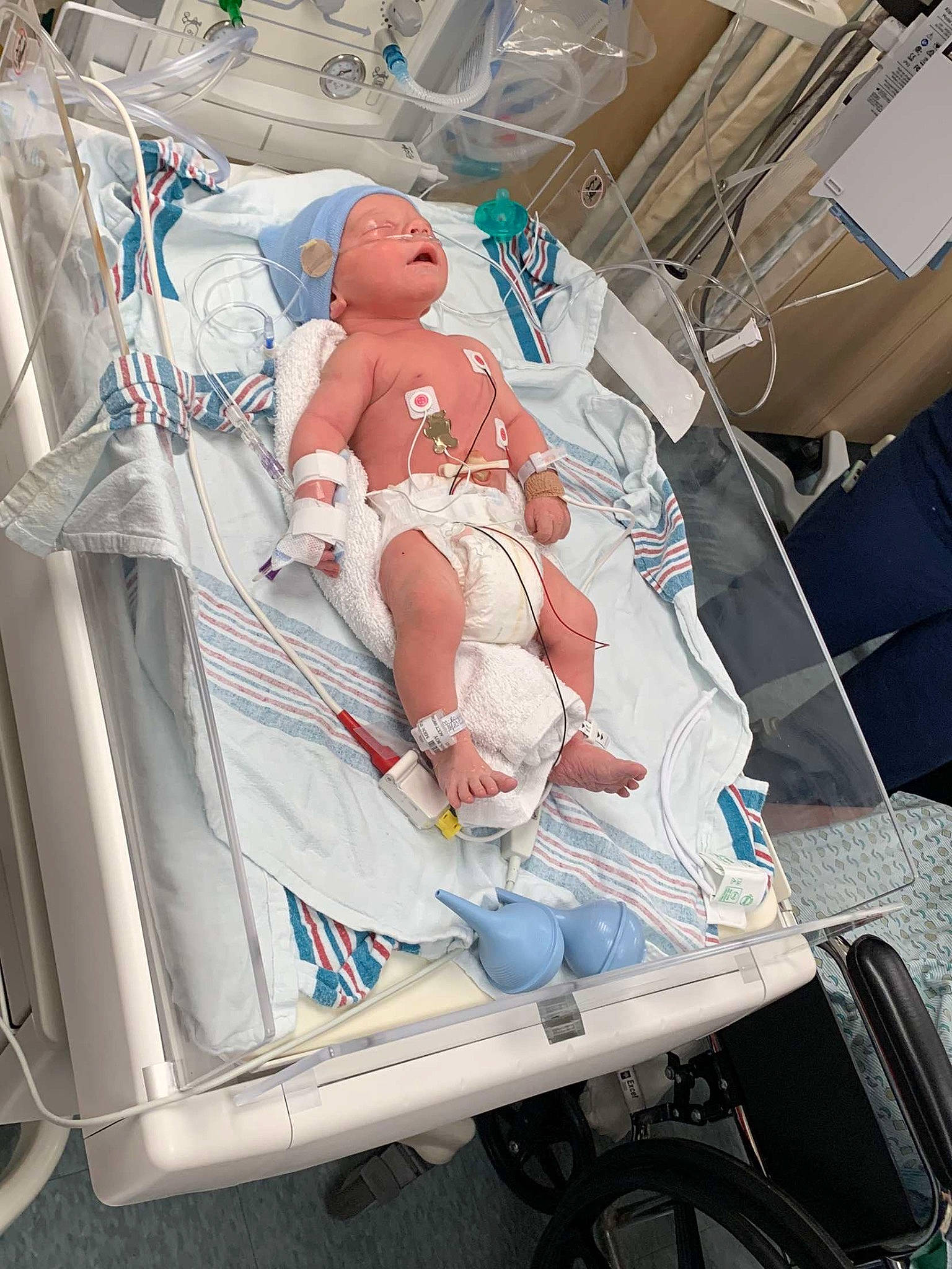 Silas is registered to the contest to win money with this photo: baby, baby_products, child, comfort, diaper, event, health_care, hospital, hospital_bed, human_body, human_leg, medical, medical_equipment, motor_vehicle, person, plastic, service, thigh, tire, toddler