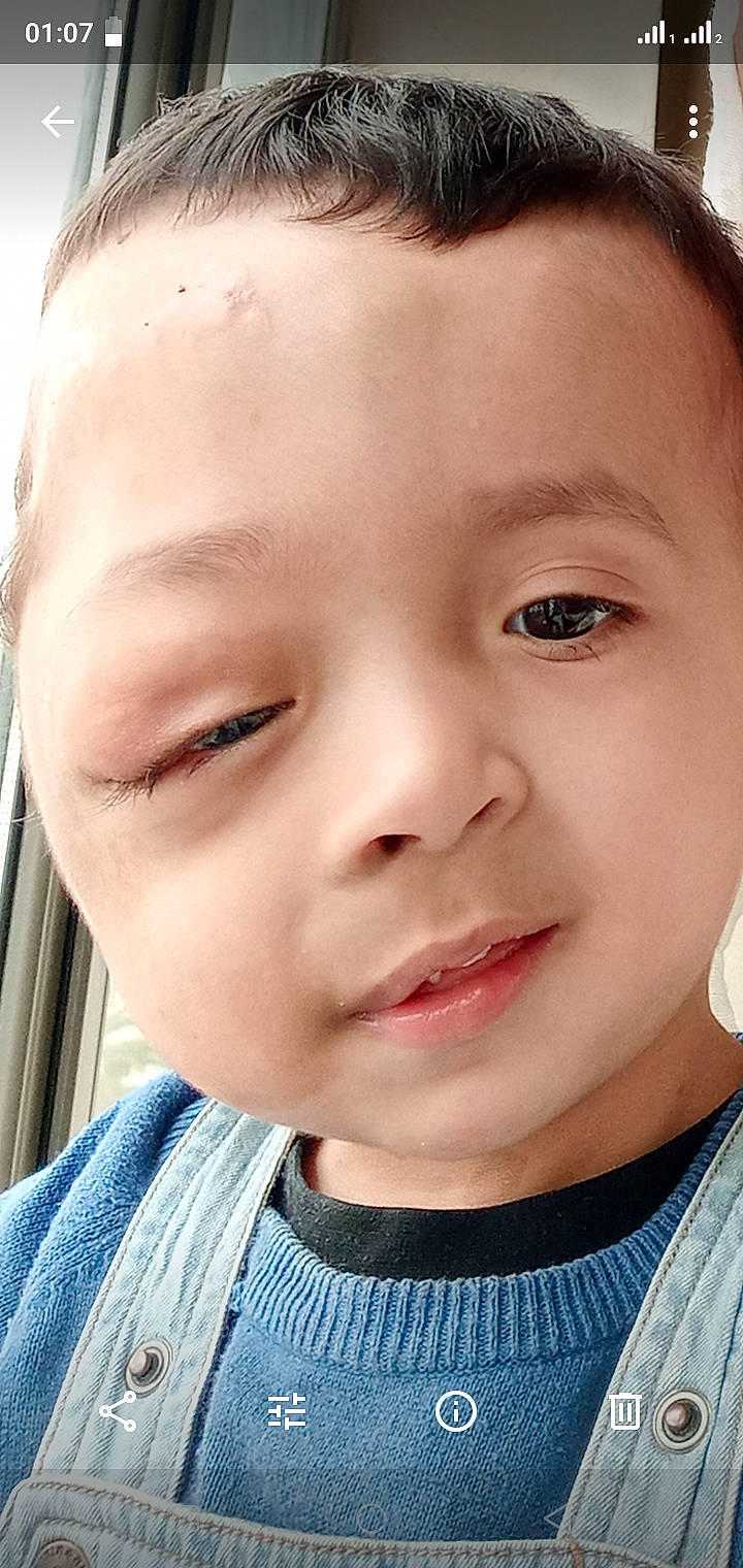 Ahmed participe au concours pour gagner de l'argent avec cette photo : baby, beauty, cheek, child, chin, close_up, ear, eye, eyebrow, eyelash, face, forehead, hair, head, jaw, lip, mouth, nose, person, skin