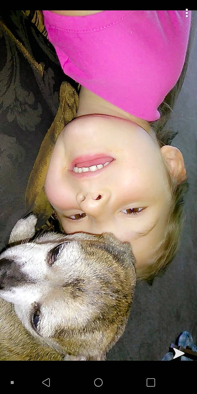 Katelyn joined the competition — help win amazing prizes! child, fawn, fur, nose, person, puppy_love, skin, snout