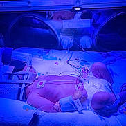 Leonidas is registered to the contest to win money with this photo: newborn, baby, incubator, hospital, medical, phototherapy, blue_light, monitoring, diaper, tubes, wrapping, blanket, premature, healthcare, infant, care, sleeping, patient, neonatal, medical_device
