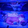 newborn, baby, incubator, hospital, medical, phototherapy, blue_light, monitoring, diaper, tubes, wrapping, blanket, premature, healthcare, infant, care, sleeping, patient, neonatal, medical_device