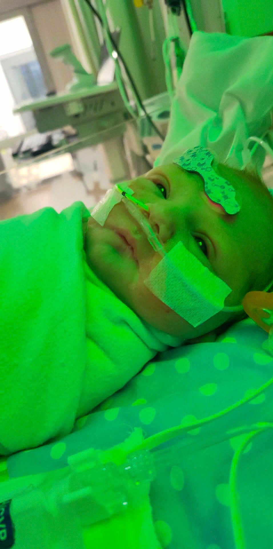 Harlee is registered to the contest to win money with this photo: baby, hospital, medical_tubes, blanket, face, infant, patient, bed, healthcare, nasal_cannula, tape, indoors, child, polka_dot, pillow, resting, monitoring, care, closeup, person