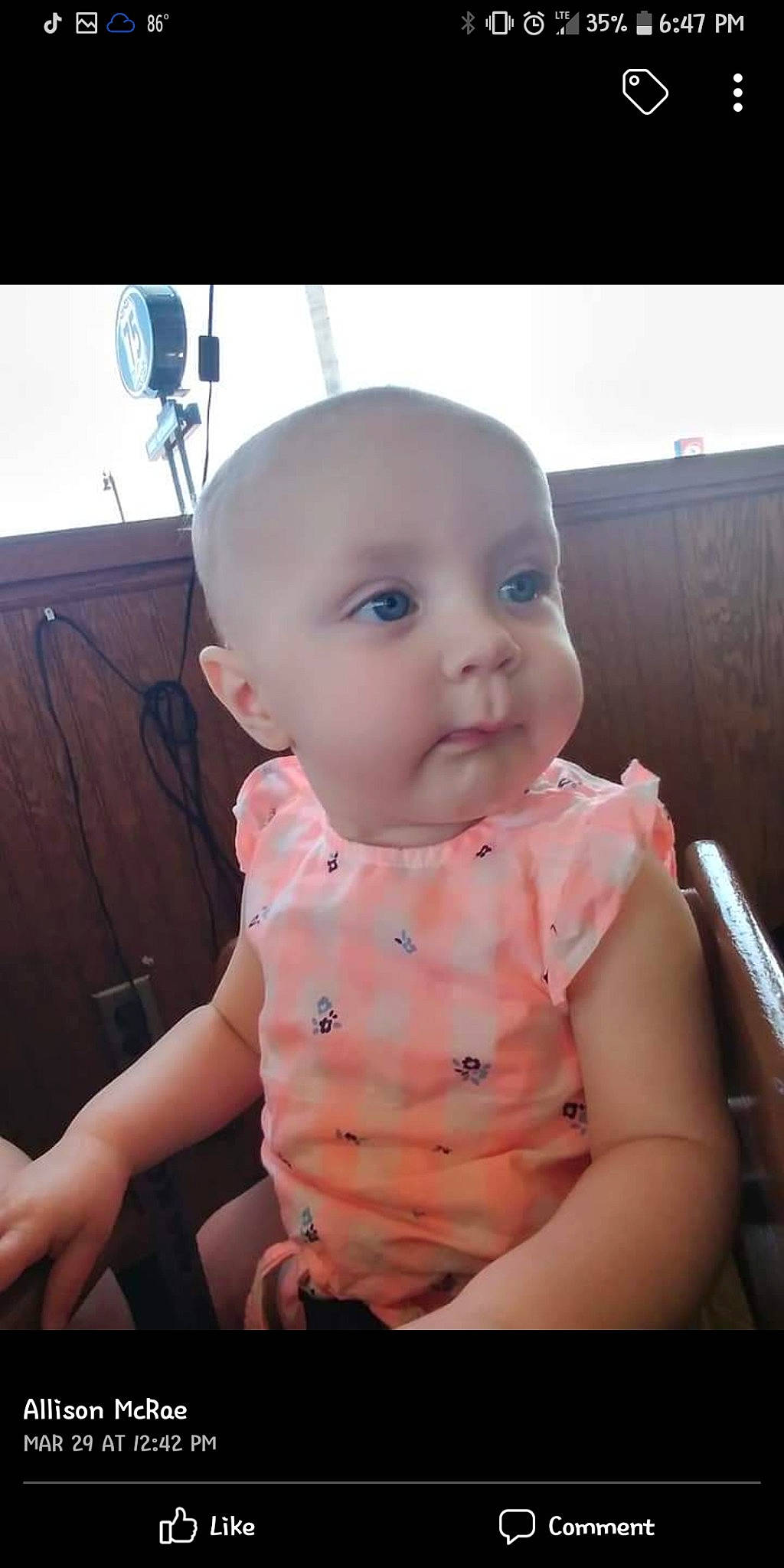 Emilee is registered to the contest to win money with this photo: abdomen, baby, baby_toddler_clothing, cheek, chest, child, comfort, eyelash, finger, flesh, happy, lip, nose, pattern, person, sitting, sleeve, stomach, thumb, toddler