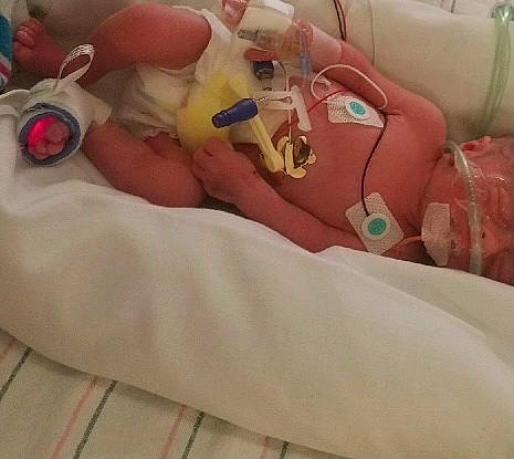 Grant is registered to the contest to win money with this photo: abdomen, carmine, chest, comfort, diaper, event, finger, foot, health_care, human_leg, knee, linens, medical_equipment, medical_procedure, nail, patient, person, stuffed_toy, thigh, thumb