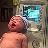 Cataleya joined the competition — help win amazing prizes! newborn, baby, infant, hospital, neonatal_care, incubator, medical_equipment, hospital_room, sleeping, yawning, striped_hat, baby_hat, portrait, face, skin, medical_monitor, weight_display, indoor, healthcare, photography