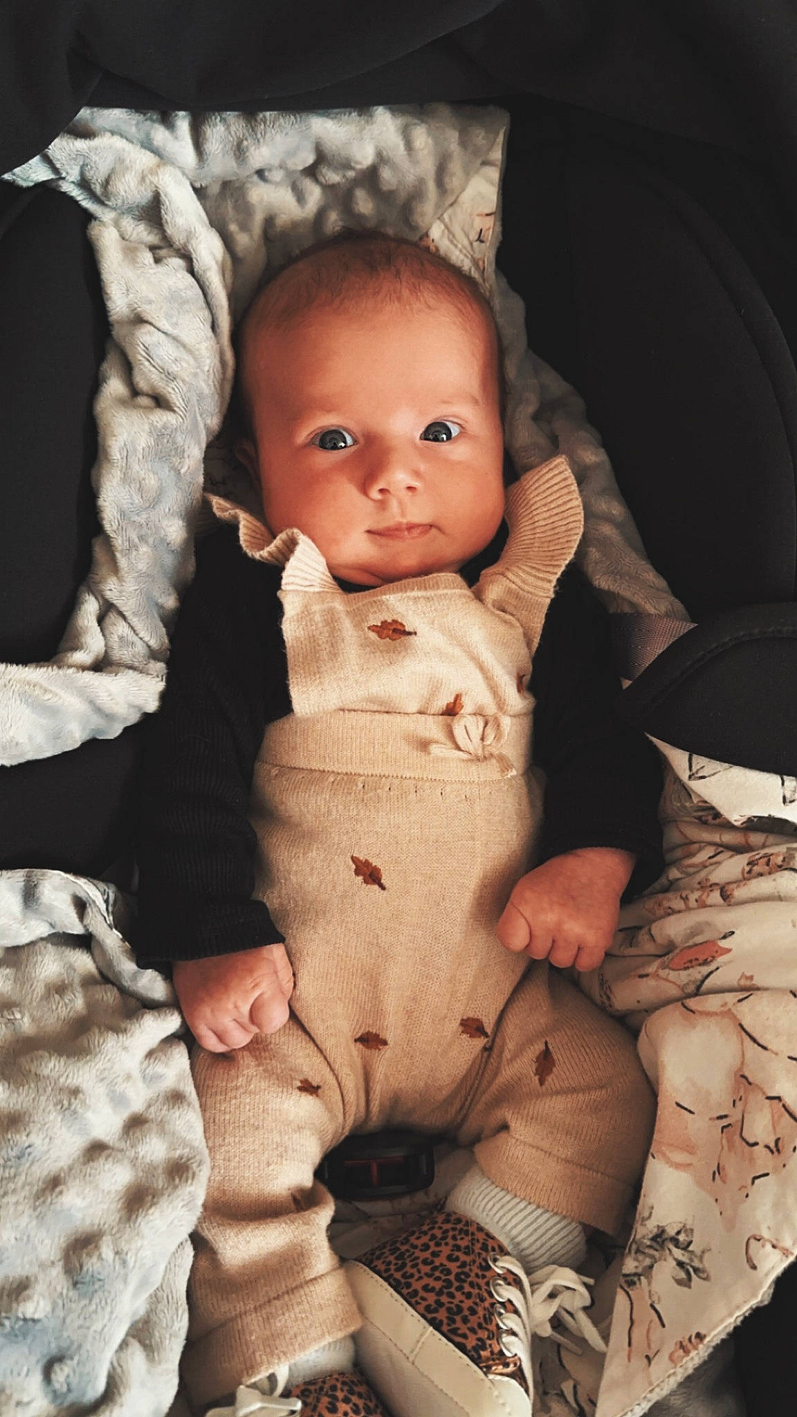 Giulya participe au concours pour gagner de l'argent avec cette photo : baby, baby_toddler_clothing, cheek, comfort, eye, face, finger, flash_photography, gesture, head, human_body, iris, leg, lip, nose, person, skin, sleeve, stomach, textile