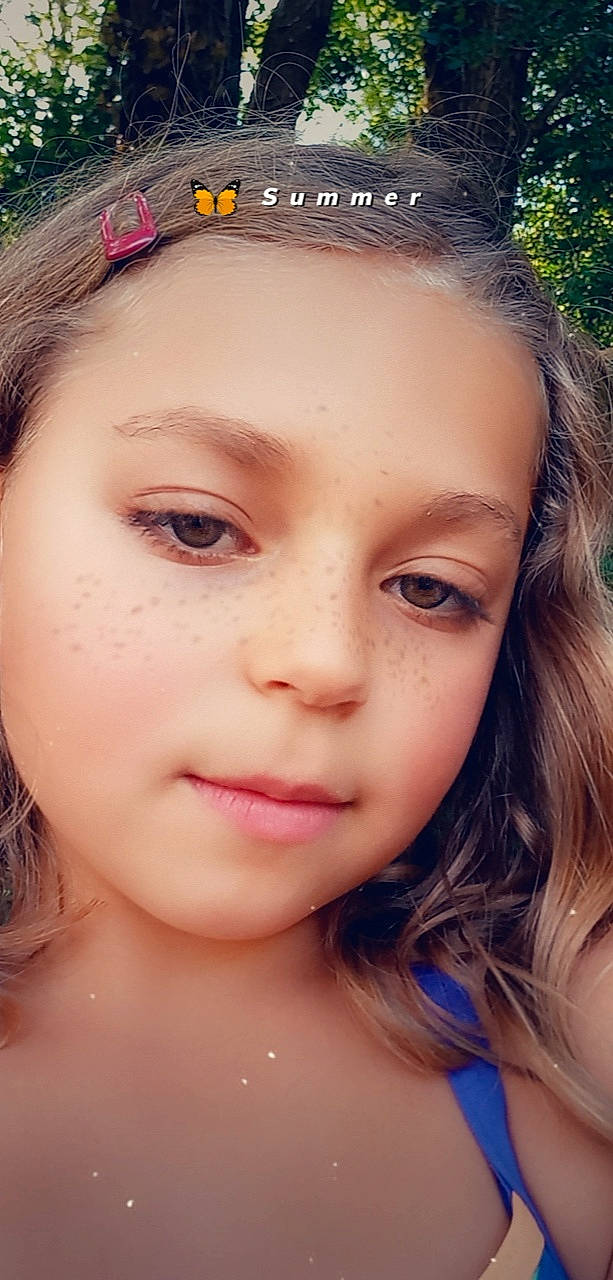 Lylou participe au concours pour gagner de l'argent avec cette photo : cheek, chin, ear, eye, eyebrow, eyelash, face, flash_photography, forehead, grass, hair, happy, head, iris, jaw, lip, mouth, neck, nose, person