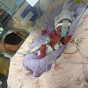 Hope joined the competition — help win amazing prizes! baby, incubator, premature, hospital, medical_equipment, blanket, tubes, newborn, bed, infant, care, healthcare, person, fragile, clothing, pink, purple, small, lying_down, monitoring