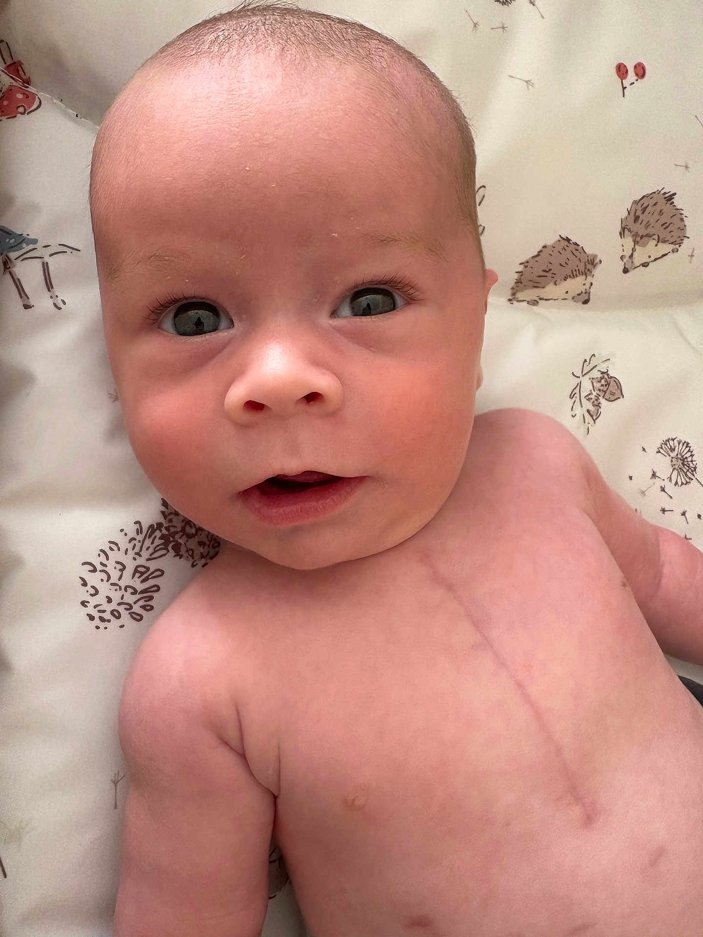 Arthur joined the competition — help win amazing prizes! baby, infant, face, skin, scar, lying_down, curious, wide_eyes, mouth_open, patterned_sheet, hedgehog_pattern, child, portrait, close_up, human, newborn, soft_lighting, indoors, cute, expression