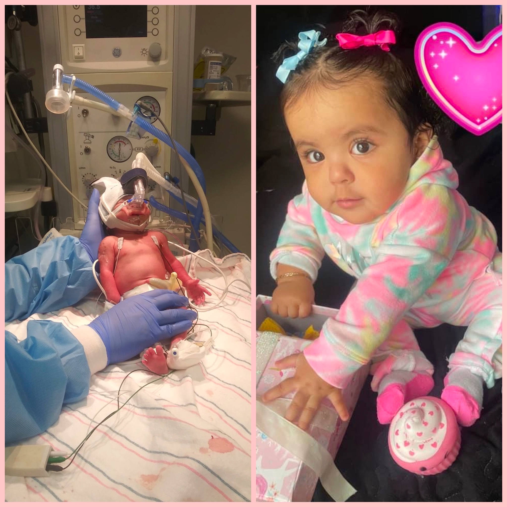 Daleyza joined the competition — help win amazing prizes! baby, baby_products, baby_toddler_clothing, cheek, child, eyelash, happy, health_care, linens, magenta, medical, medical_equipment, medical_procedure, patient, pattern, person, room, science, service, skin