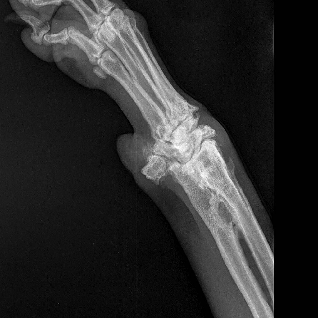 Gaïa participe au concours pour gagner de l'argent avec cette photo : bone, human_body, human_leg, leg, medical, medical_imaging, medical_radiography, monochrome, monochrome_photography, radiography, radiology, science, service, still_life_photography, transparent_material, x_ray