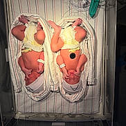 Matthew And Michael is registered to the contest to win money with this photo: baby, bassinet, blanket, diaper, hospital, hospital_crib, infant, knit_hat, medical_equipment, monitor_lead, newborn, nursery, skin, sleeping, striped_sheet, swaddled, tiny_hands, twins, umbilical_clamp, wristband